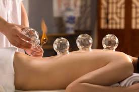 cupping 
